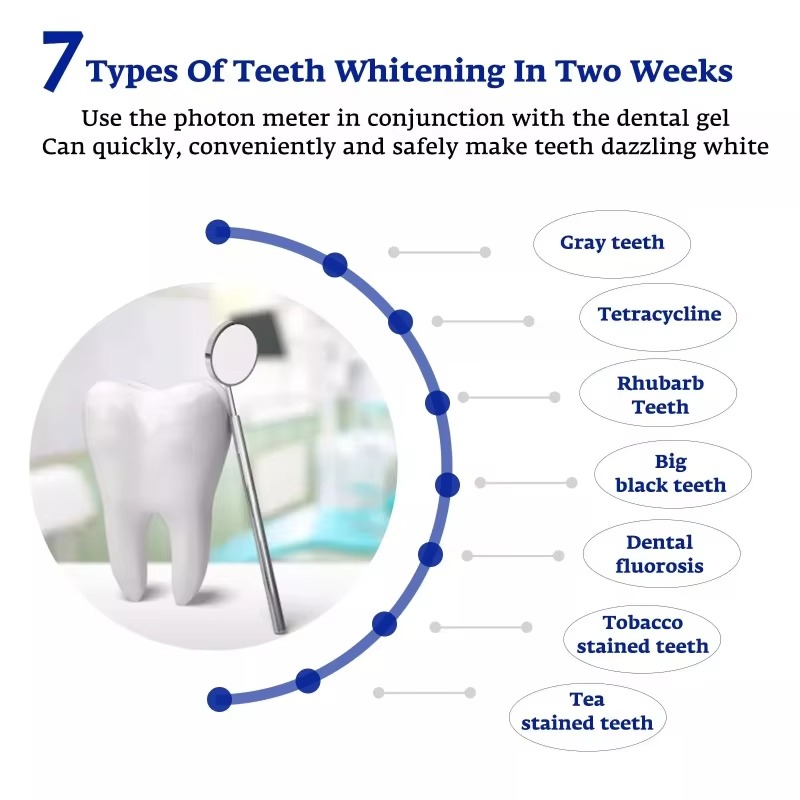 インテリジェントLEDブルーライトポータブルUSB/iPho - Teeth Whitening Blue Light のレビューと価格