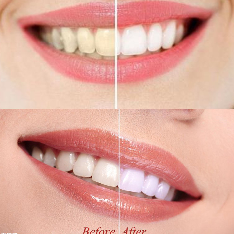 竹炭歯,口腔衛生,煙のホワイトニング,新鮮な呼吸のための歯の - Teeth Whitening Charcoal Powder のレビューと価格