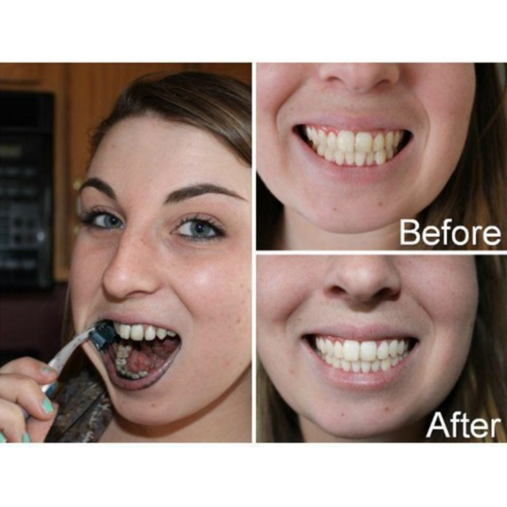 竹炭歯,口腔衛生,煙のホワイトニング,新鮮な呼吸のための歯の - Teeth Whitening Charcoal Powder のレビューと価格