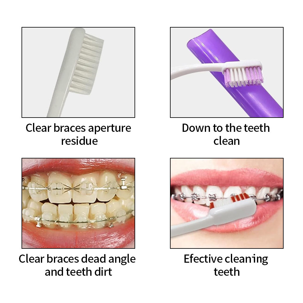 8 ピース/セット矯正歯科ケアブラシキット歯クリーニングブレ - Teeth Whitening For Braces のレビューと価格