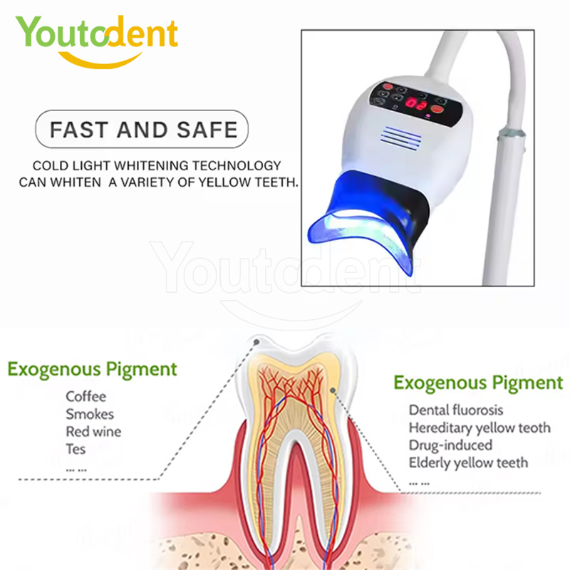 プロフェッショナル歯科 3 色ライトランプ歯ホワイトニングマ - Teeth Whitening Light Kit のレビューと価格