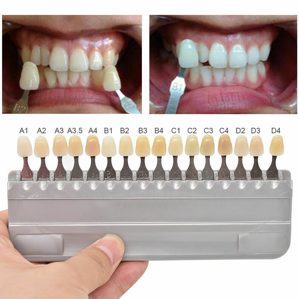 VITA 16 色歯のシェードガイド古典的な歯科機器歯ホワイ - Teeth Whitening Shade Guide のレビューと価格