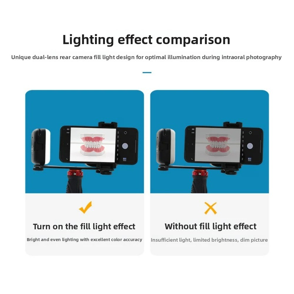 歯科用撮影ライト、スマートフォン用Bluetooth LED - Teeth Whitening Led Kit のレビューと価格